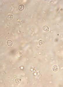 ZeoAqua vattenrening stoppar och fångar även upp ägg från parasiten Cryptosporidium